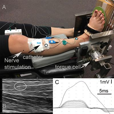 Intramuscular Pressure of Human Tibialis Anterior Muscle Reflects in vivo Muscular Activity
